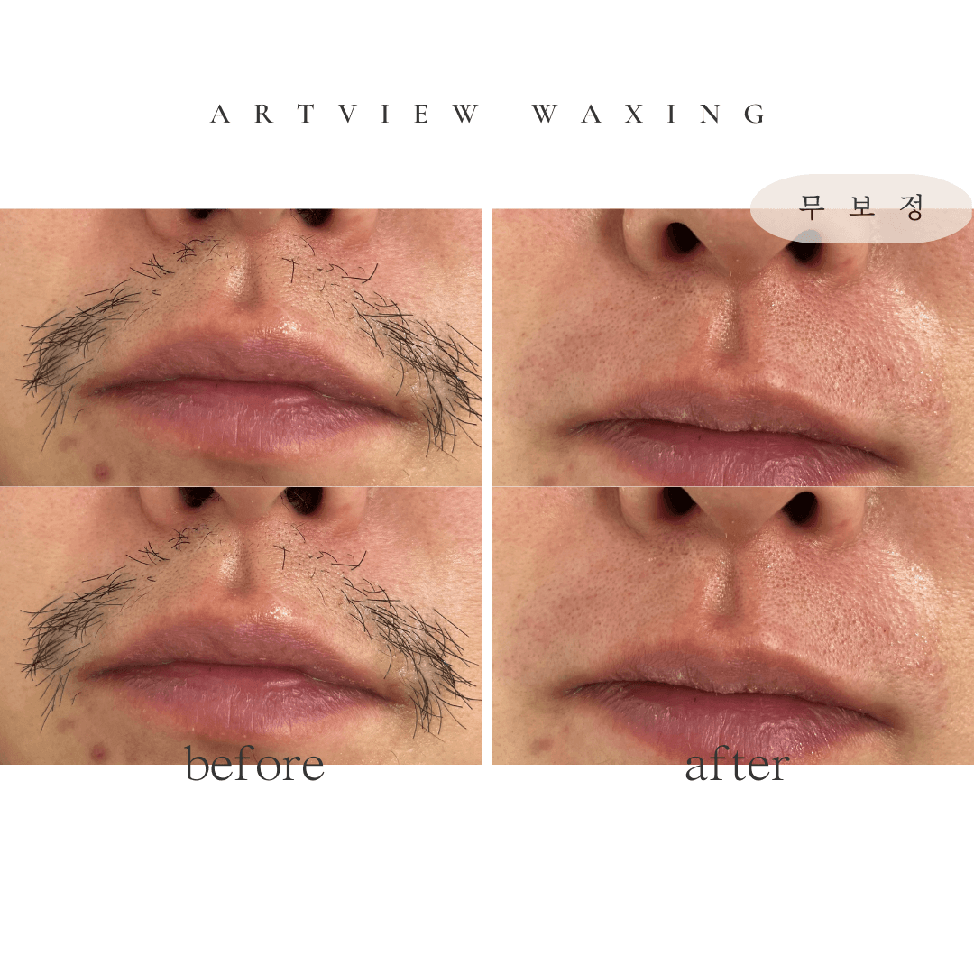 아트뷰 시세 카더라